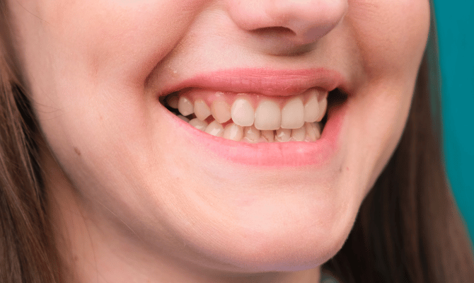 Benefits of Saving Your Natural Teeth