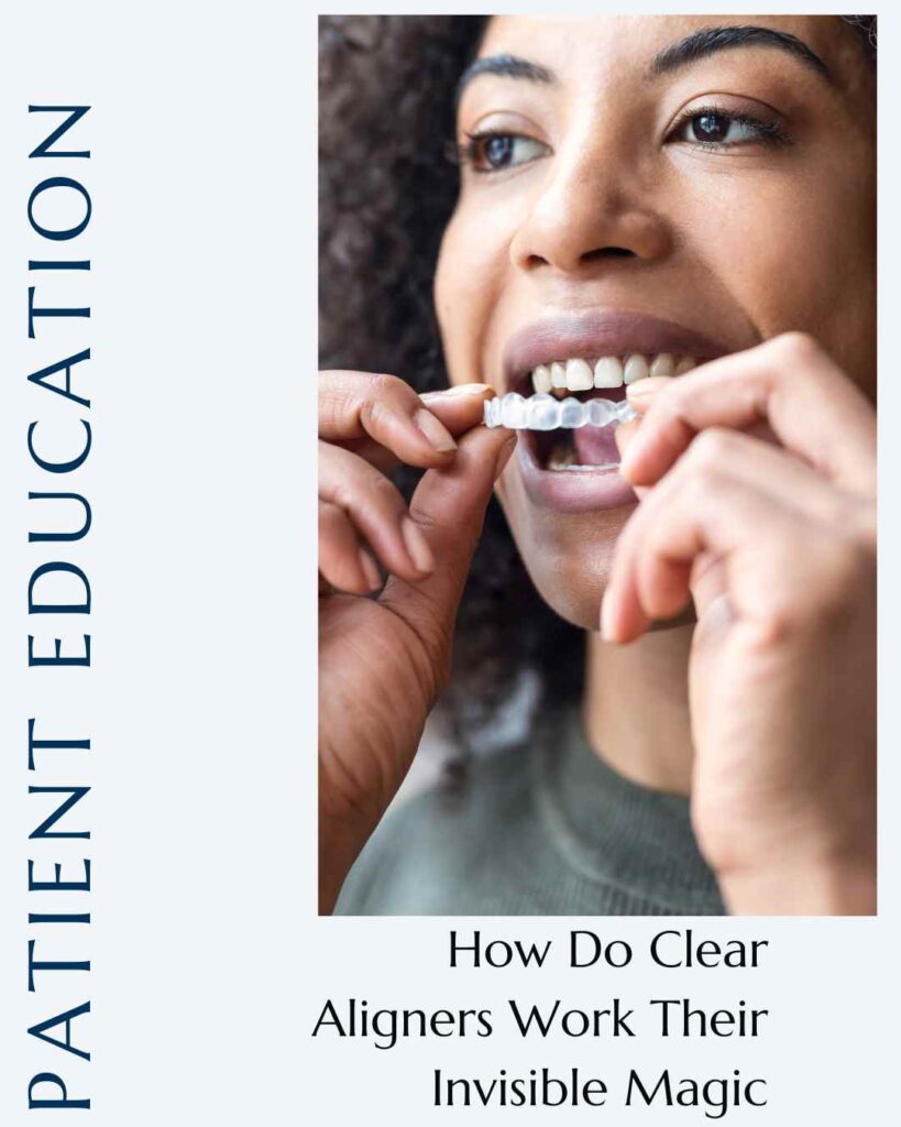 Featured Image - for the Blog post. Reads: "How Do Clear Aligners Work Their Invisible Magic."