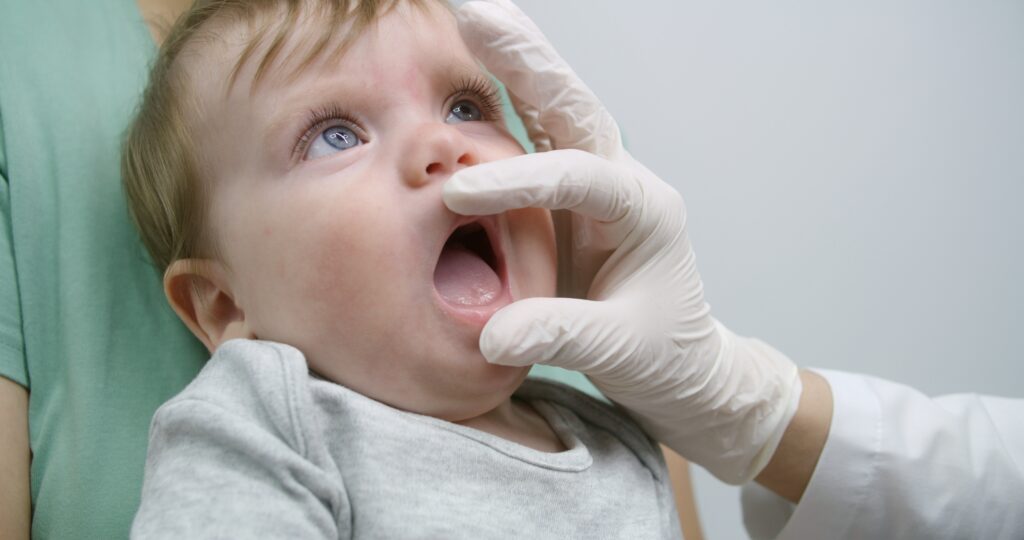 Taking your child to the dentist