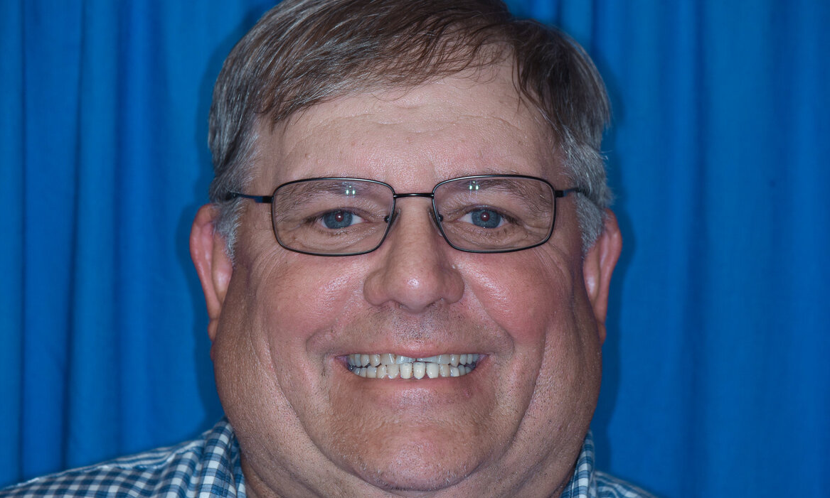 Patient's restored smile after dental implant treatment at Randall K. McVey, DMD PA in Garden City, KS