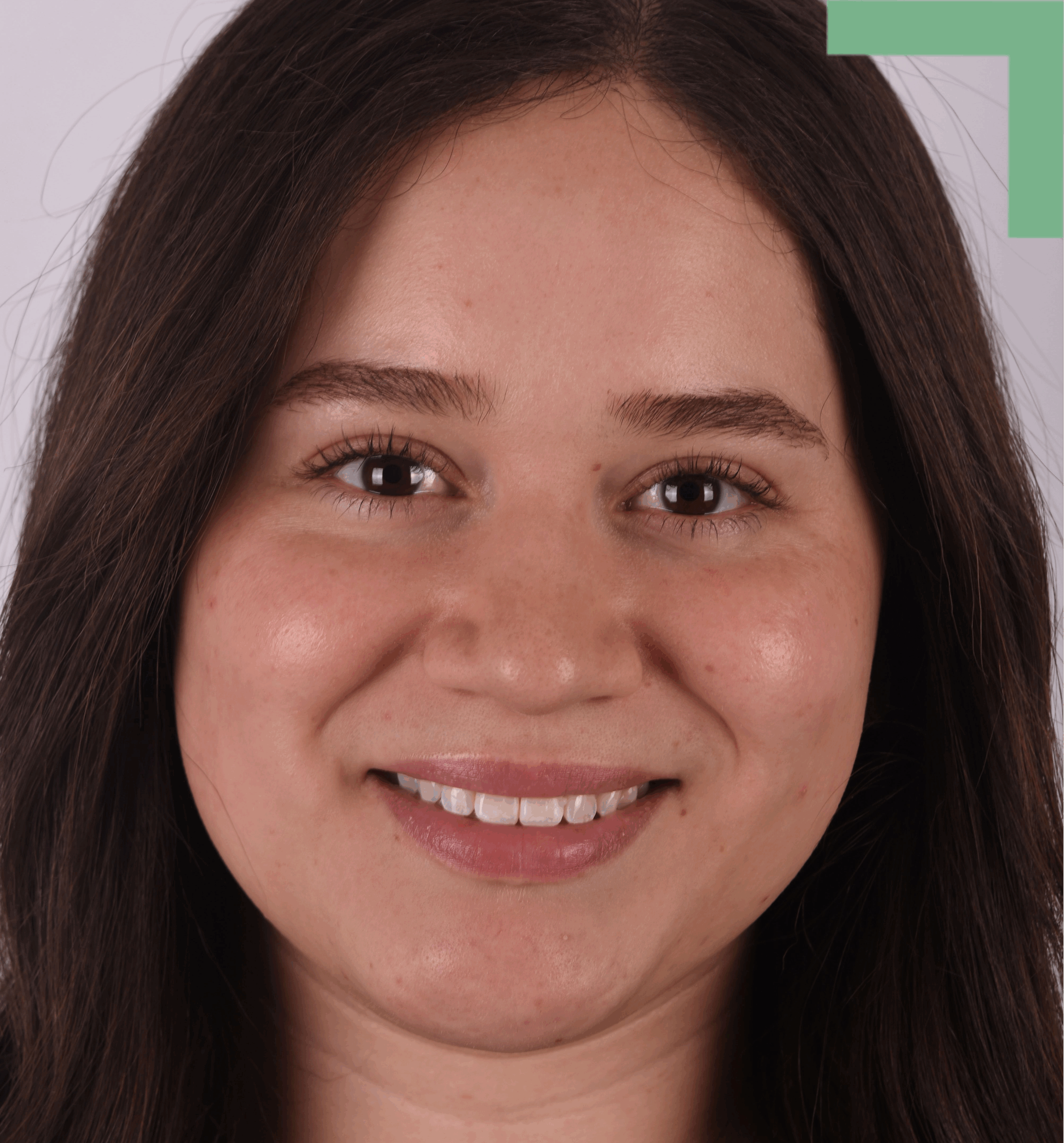 Alejandra Dental Hygienist Randall K. McVey DMD PA Garden City KS Alejandra, dental hygienist at Randall K. McVey, DMD PA in Garden City, KS