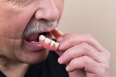 Dentures Garden City KS Man putting in custom-fitted dentures