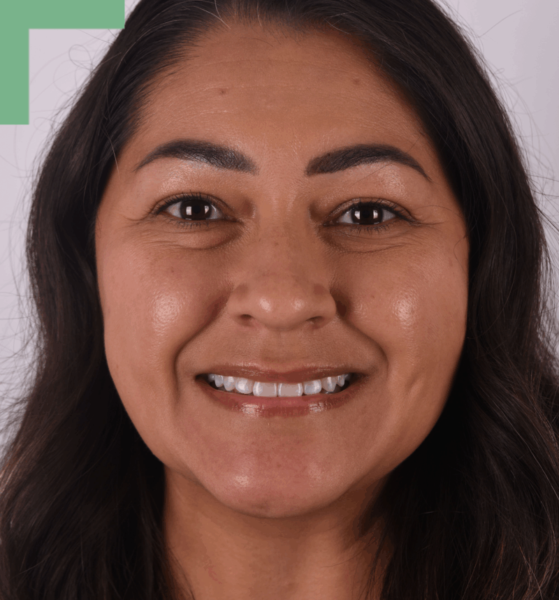 Emelia Dental Assistant Randall K. McVey DMD PA Garden City KS Emelia, dental assistant with 20 years of experience at Randall K. McVey, DMD PA in Garden City, KS