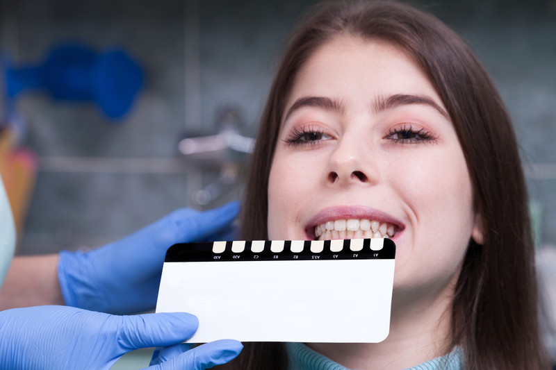 How Long Do Veneers Last? Care & Maintenance How Long Do Veneers Last? Care & Maintenance